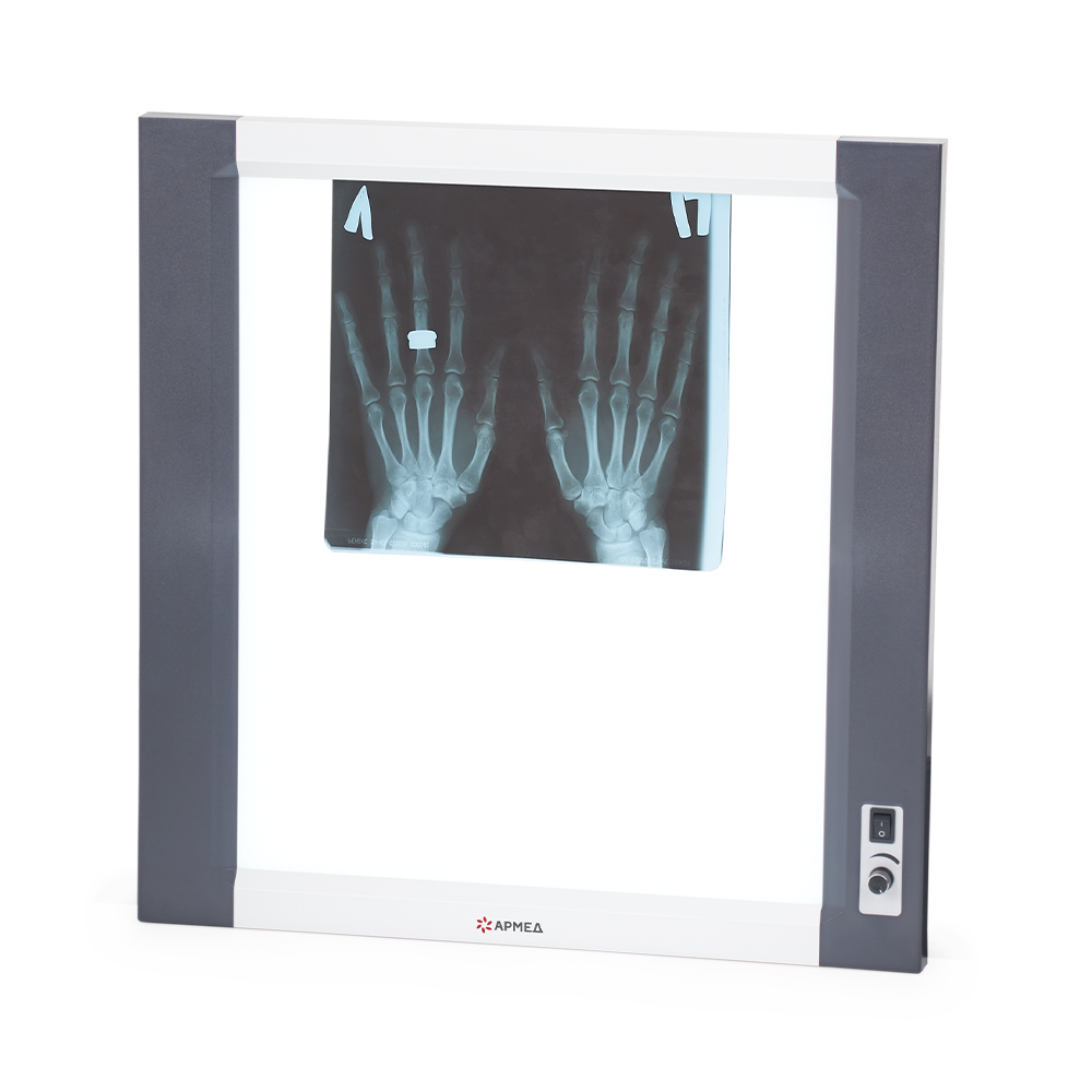 Негатоскоп общего назначения Армед 1-кадровый LUX 